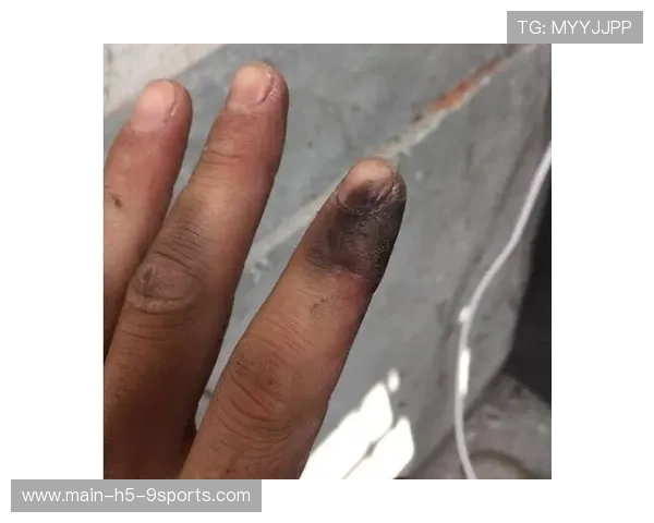 高压造失误，引发对手自乱阵脚，高压电事故案例集锦